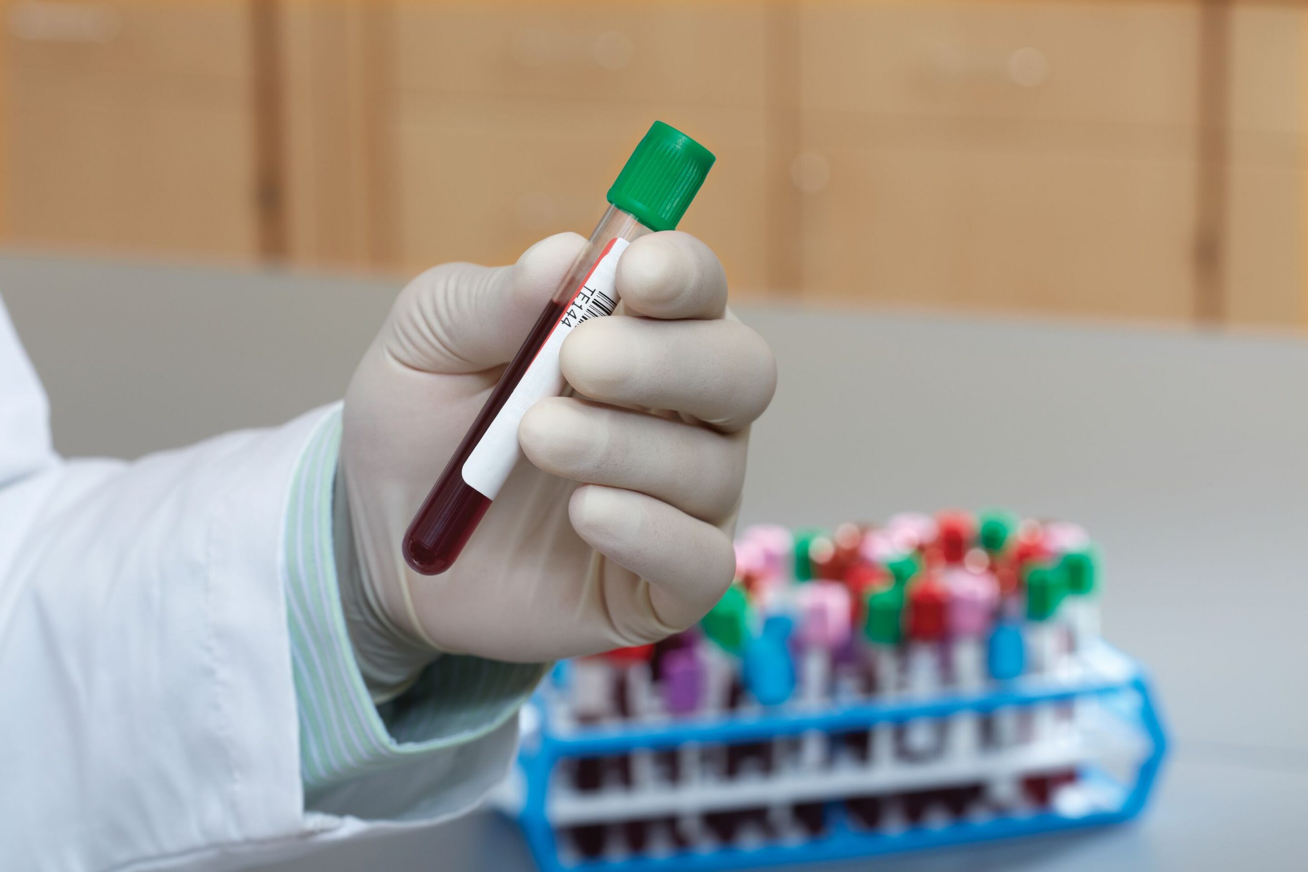 Hemostasia-imagen-scaled
